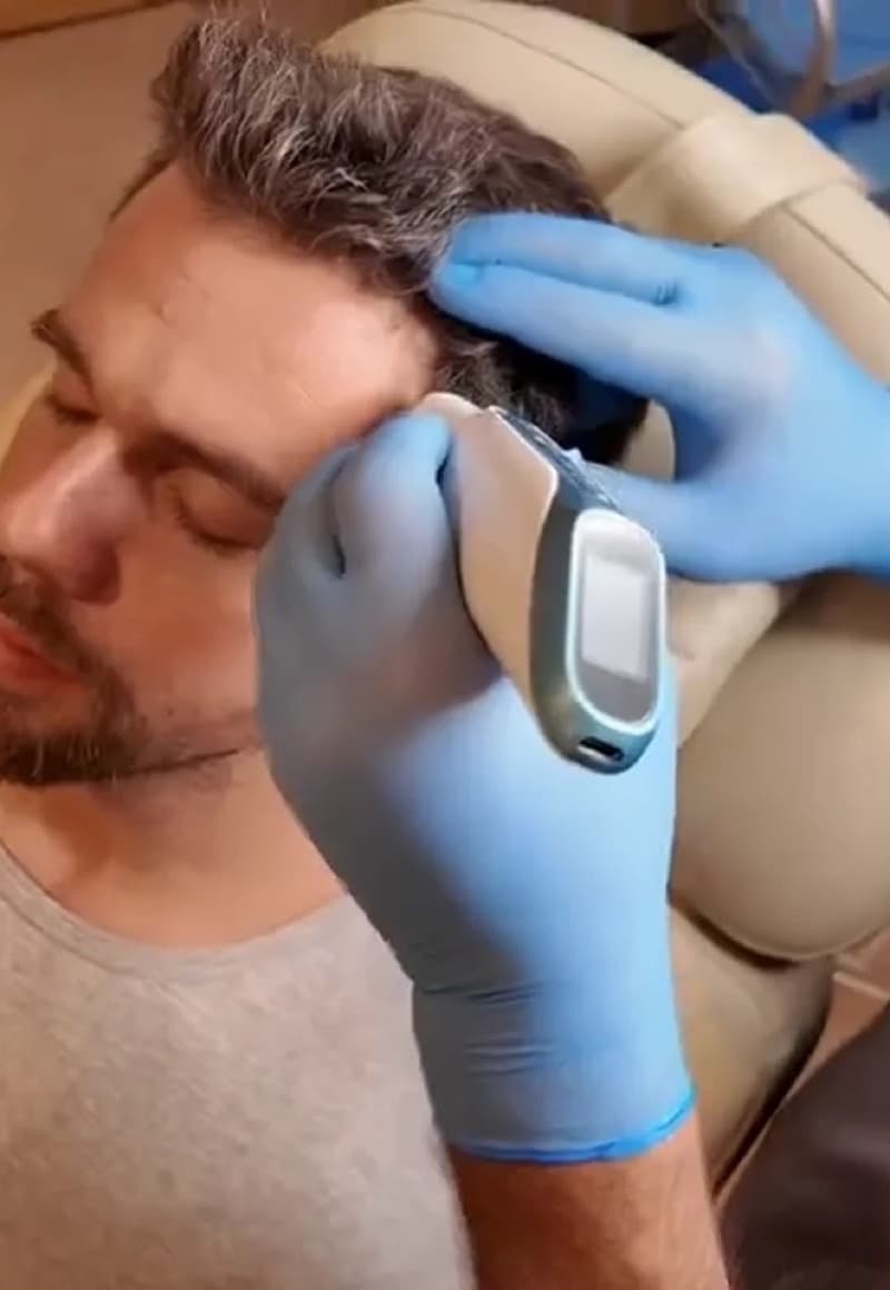A scalp scan with a gloved hand and a handheld device